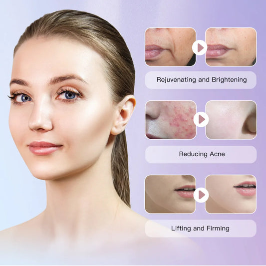 Clinvara Pro — HiFu Ultrasonic Face Lifting Device